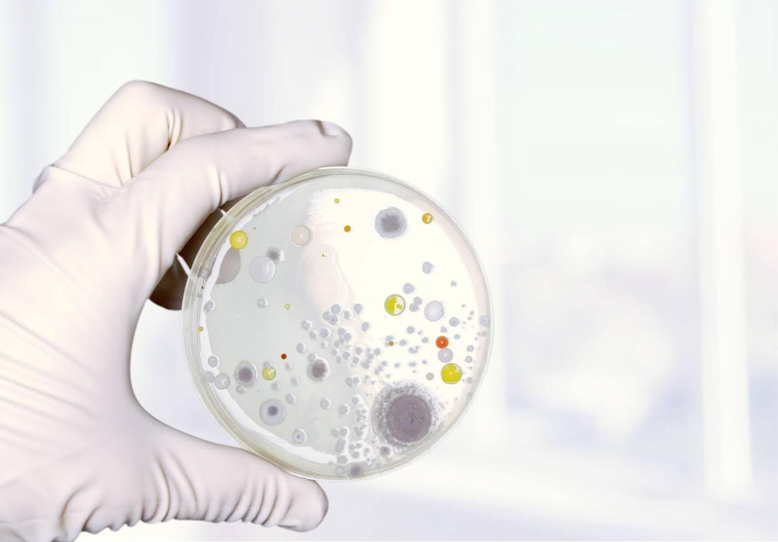 A person holding a petri dish containing visible bacteria colonies